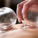 Does Cupping Therapy Work and What Are The Benefits? 11