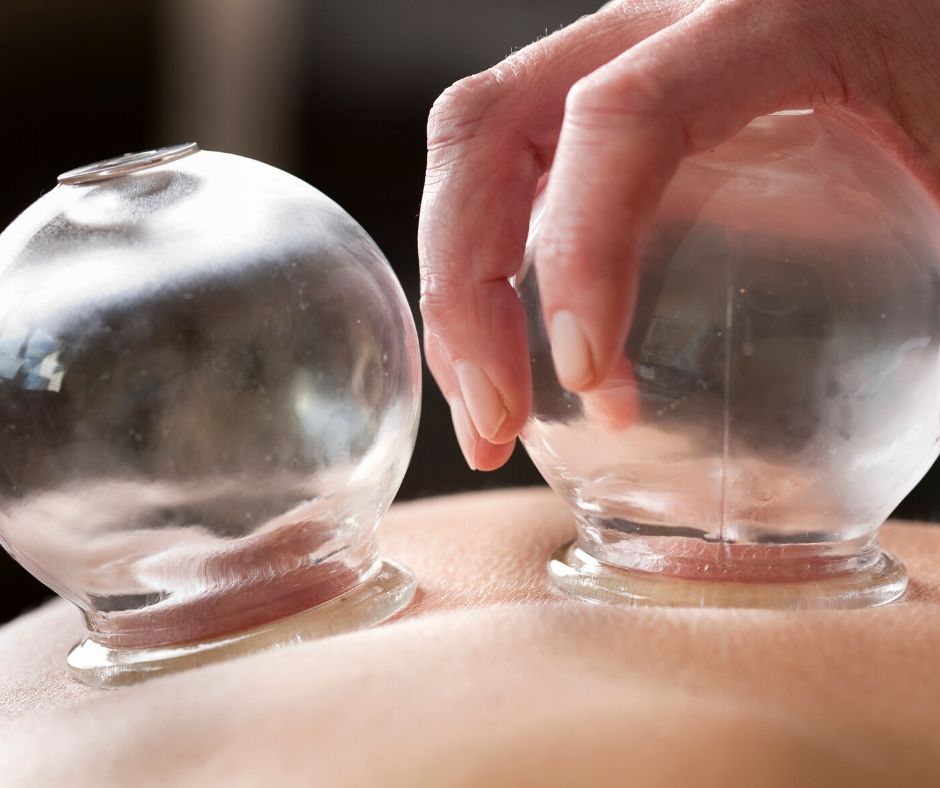 Does Cupping Therapy Work and What Are The Benefits? 10
